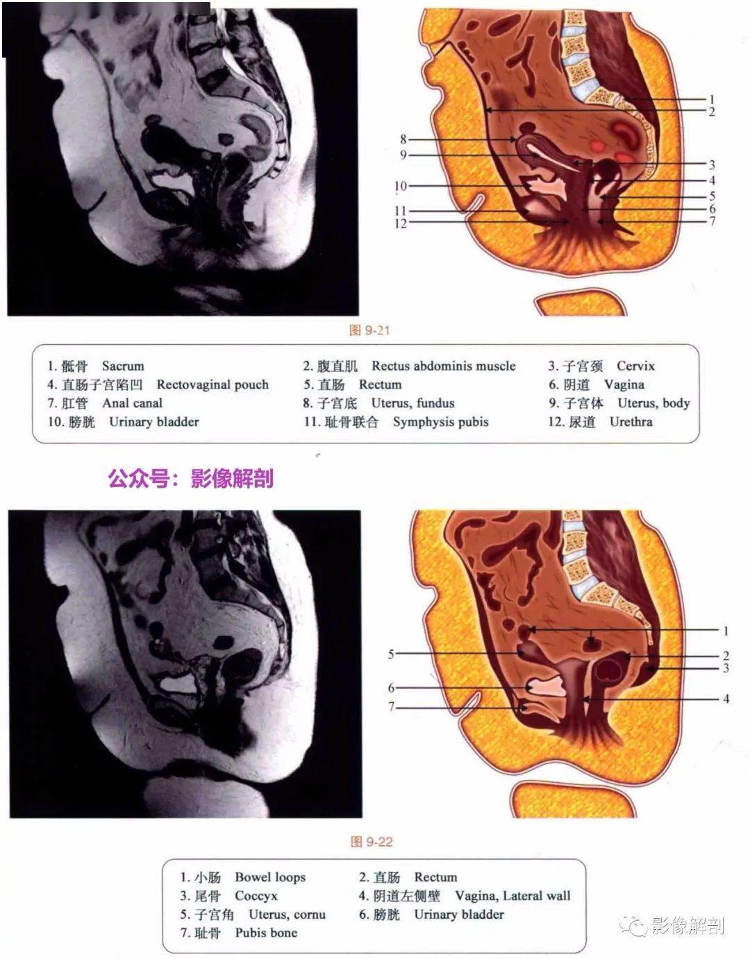 断层图谱 男,女性盆腔解剖图谱