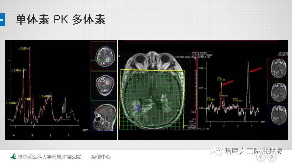 磁共振的原理是什么