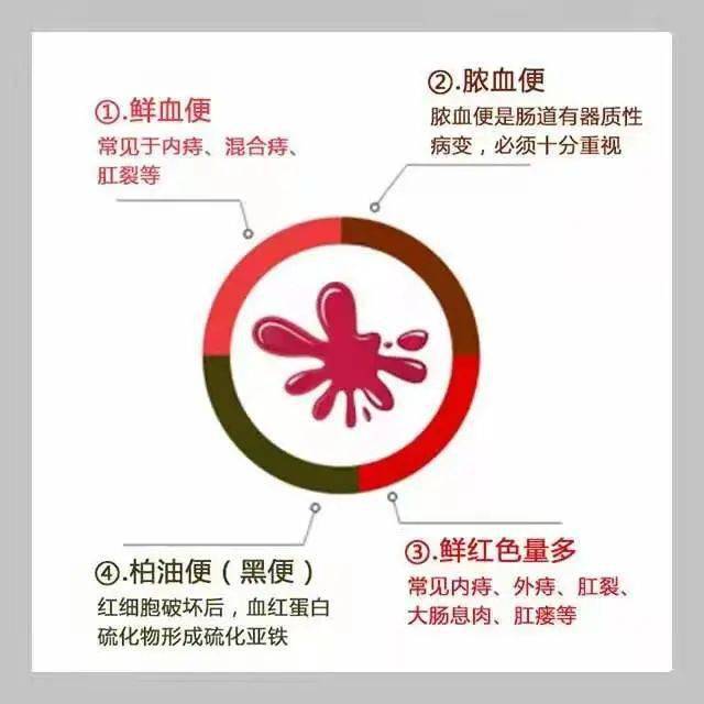 肛肠问题 之 大便带血