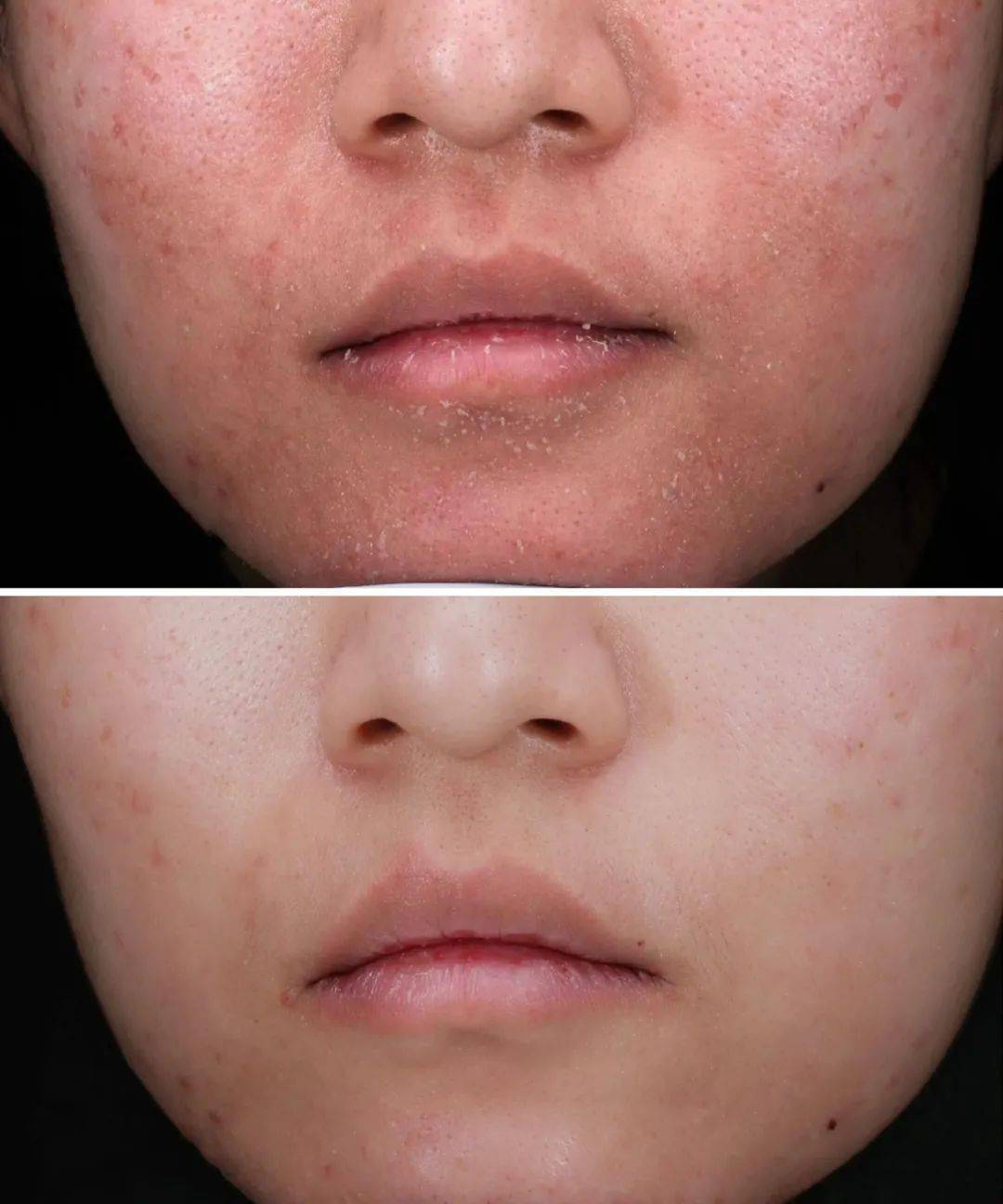 昆明人本周上海专家莅昆亲诊解决早春皮肤难题