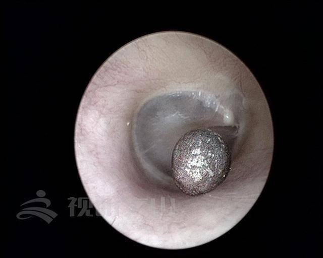 耳朵内部照片图片
