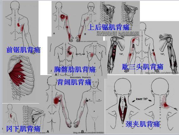 全身激痛点手册