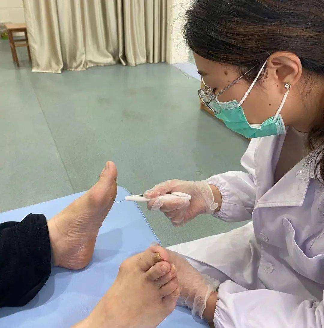 无创性神经功能检查仪器,是对糖尿病深感觉的神经定量检查,能较稳定的