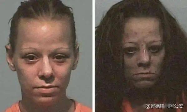 22岁女子吸毒6年瘦到脸凹牙拔光