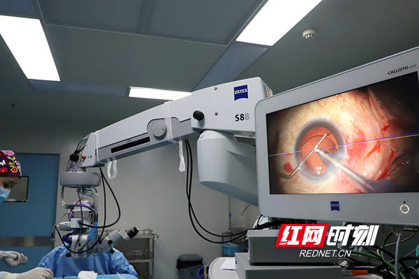 衡阳|衡阳首台！爱尔眼科开展导航手术显微镜下散光人工晶体植入手术