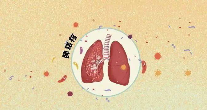 什么是肺结核?如何预防_传播
