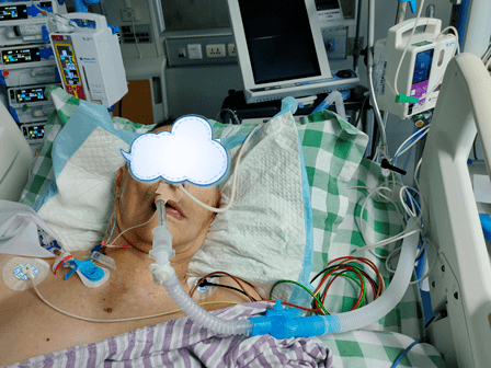 聚焦临床前沿十八生死极速紧急救援我院ecmo成功救治81