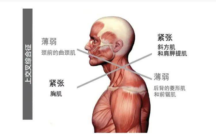 帮每个驼背的人赢回气质 肌肉