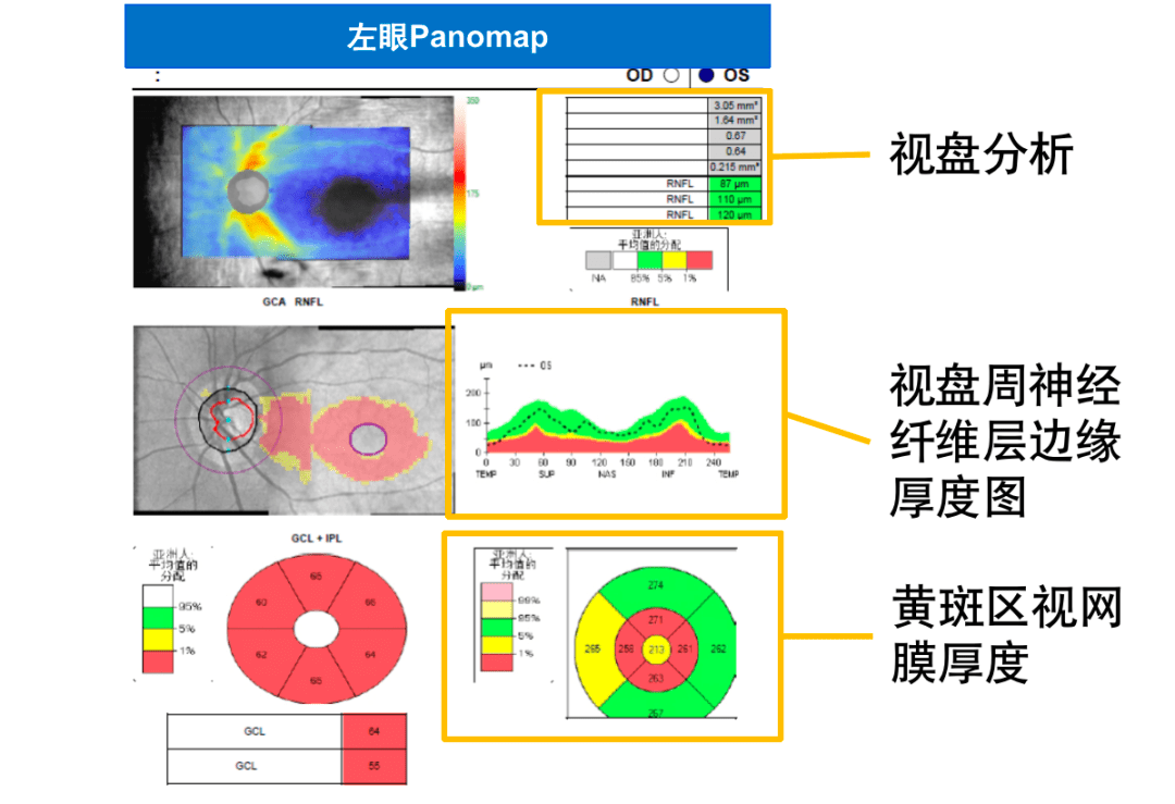 视盘结构图片