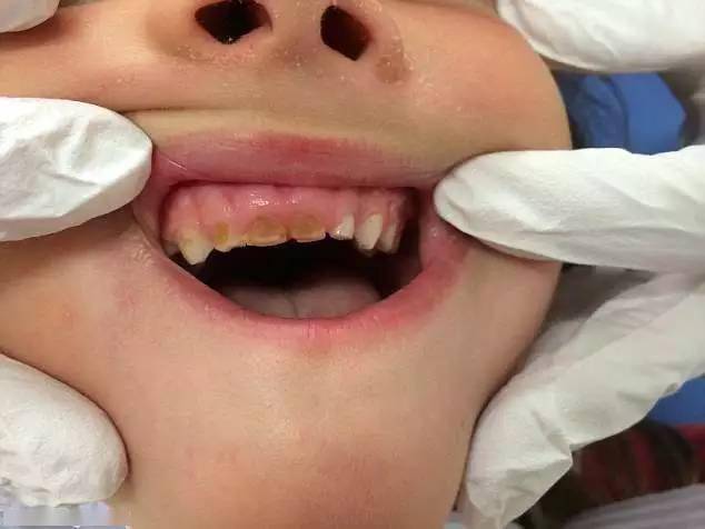 牙医不得不给人们看看这些恐怖的照片