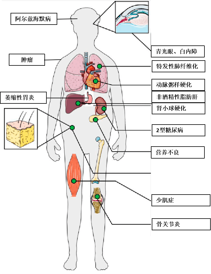 导致衰老的几大元凶,竟是这些…_人体