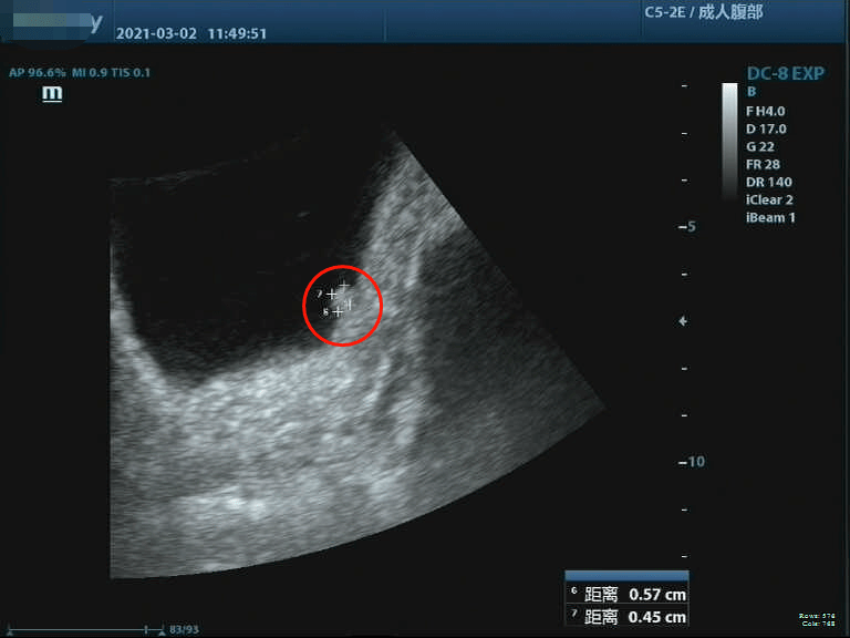 彩超结果当天就出来了