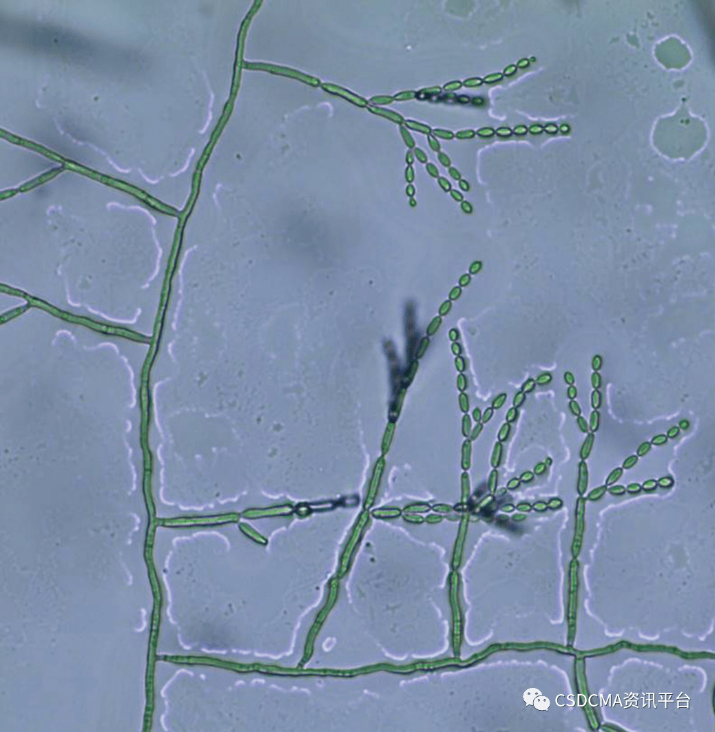 28℃,2周)接着,我们挑取少许真菌用平皿培养,2周长出了非常美丽的菌落