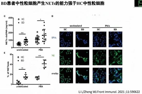 白塞病研究进展有哪些 且听协和主任分解 患者