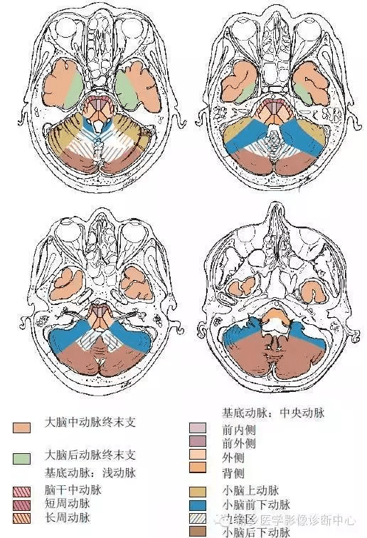 腦血管解剖圖譜詳細標註腦梗死責任血管判定