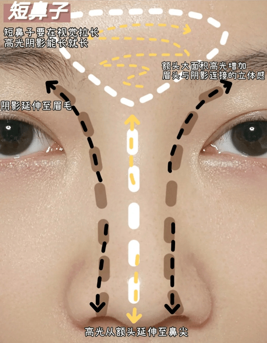 什么样的鼻子不算蒜头鼻 3efe30f4b3aa48f385e09197b368d7dc.png