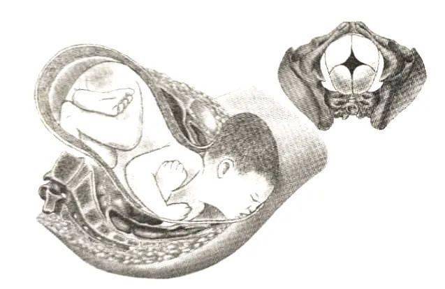 "医生,我感觉有点松,要不要去缩阴?