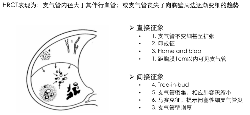 瀰漫性支氣管擴張診療難?看協和專家如何應對