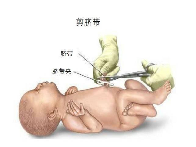 新生儿脐带被剪痛吗母亲呢