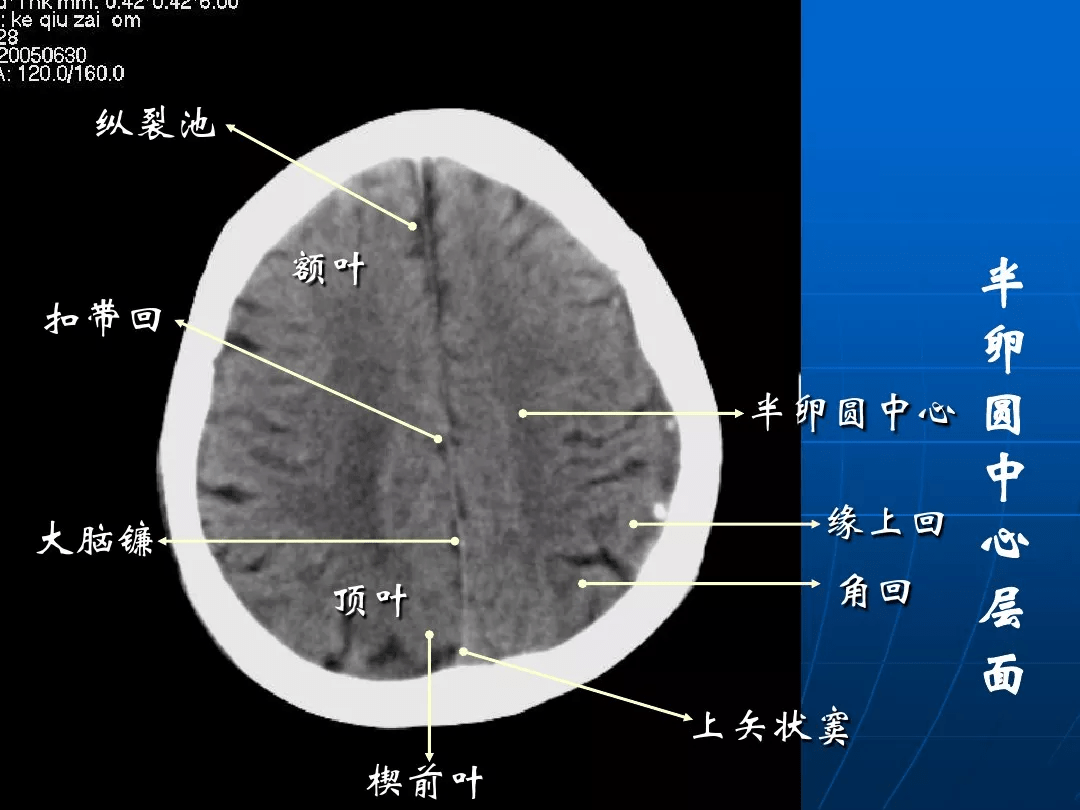 侧颅底分区图片