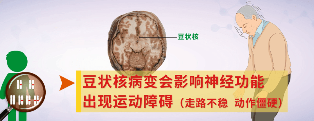 你听过低铜饮食吗?红豆、绿豆竟被列入其中“黑名单”!