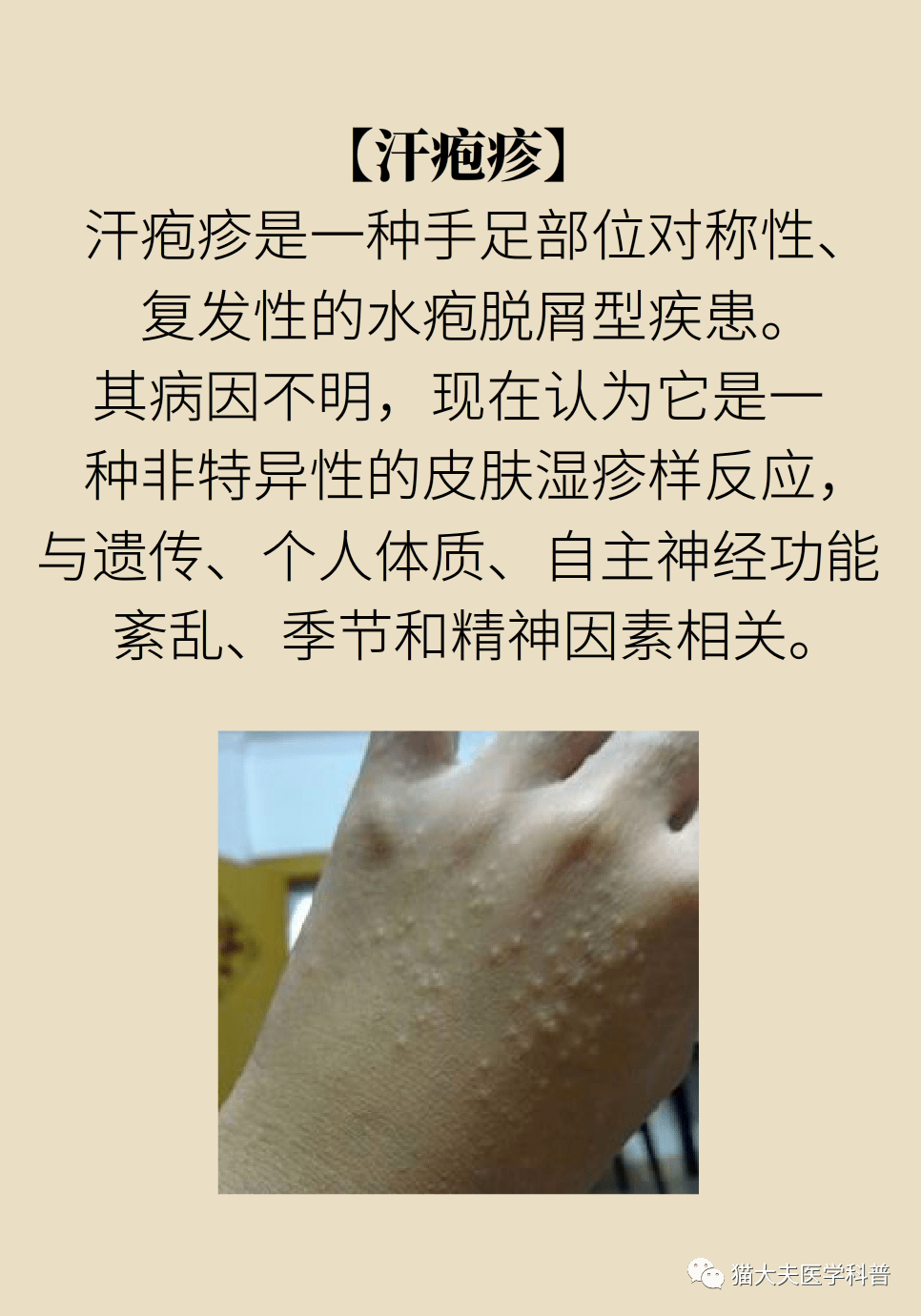 汗湿疹是怎么引起的图片