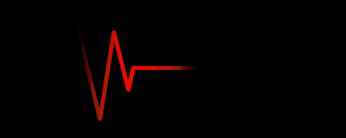 h Holter ECG_How to use the Holter ECG_Principles of the Holter