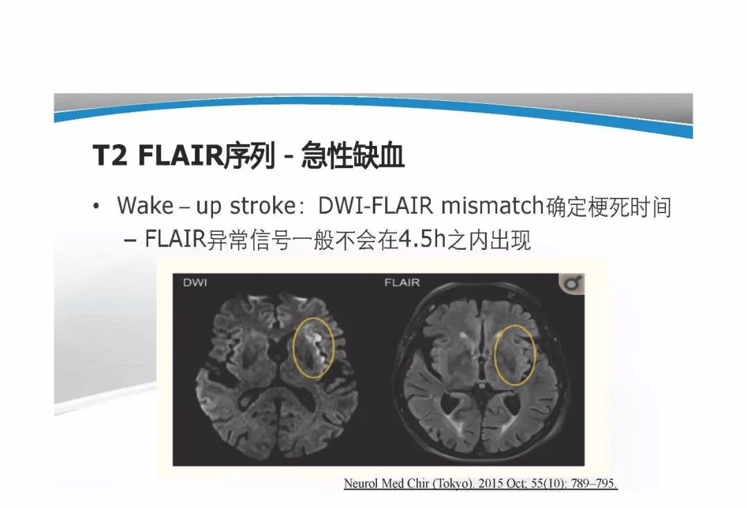t1wit2wi及flair信号分析与颅内病变图像判读