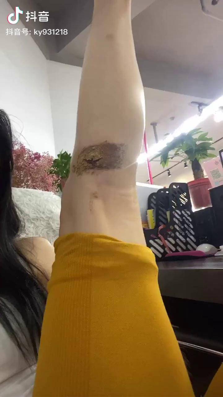 我的神仙腿残了010101