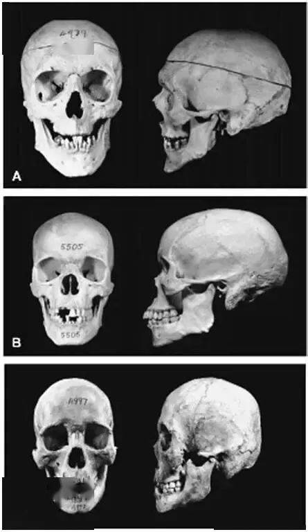 从上往下依次是白人,黑人,东亚人的头骨对比亚洲人的头骨相对宽平