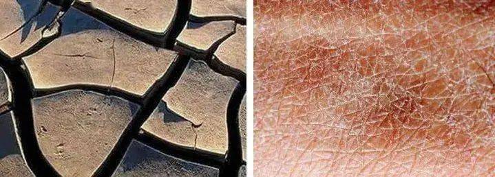 臭脚,死皮,老茧,开裂全没了!用它轻轻一搓,脚比脸还嫩!