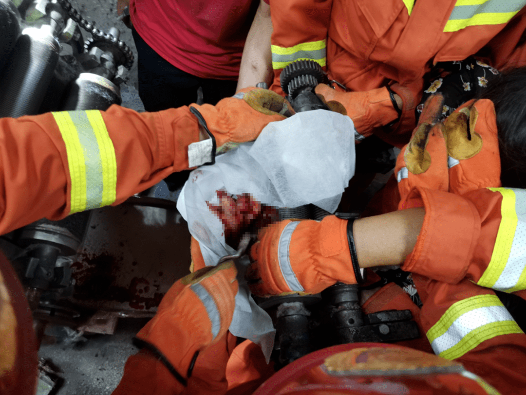 血腥慎看民众女工被机器夹手消防员却捂住她的眼睛