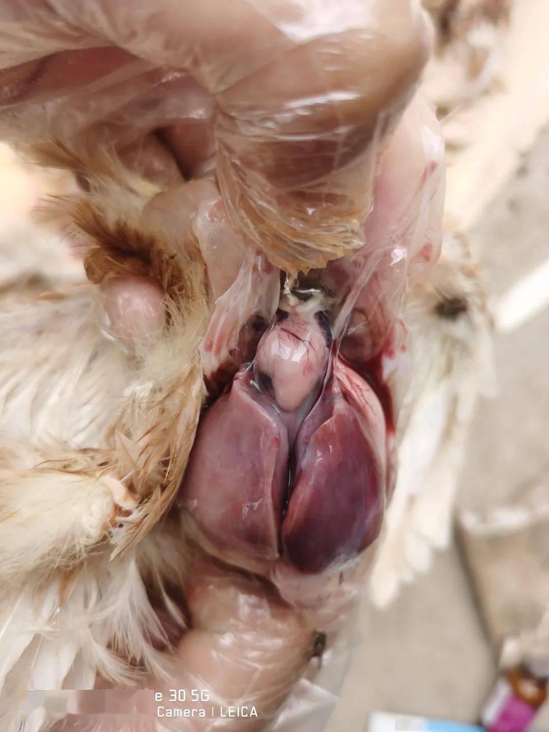 病例探讨请教老师看看这种情况可是腺病毒