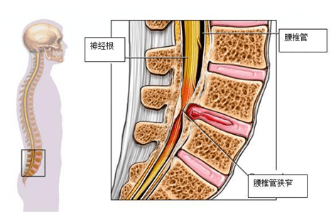 了细致的梳理,她尝试通过神经根局部消炎的方法排除炎症刺激的病因,在