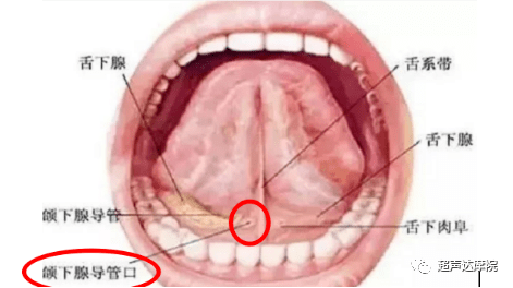 颌下腺导管开口位置图图片