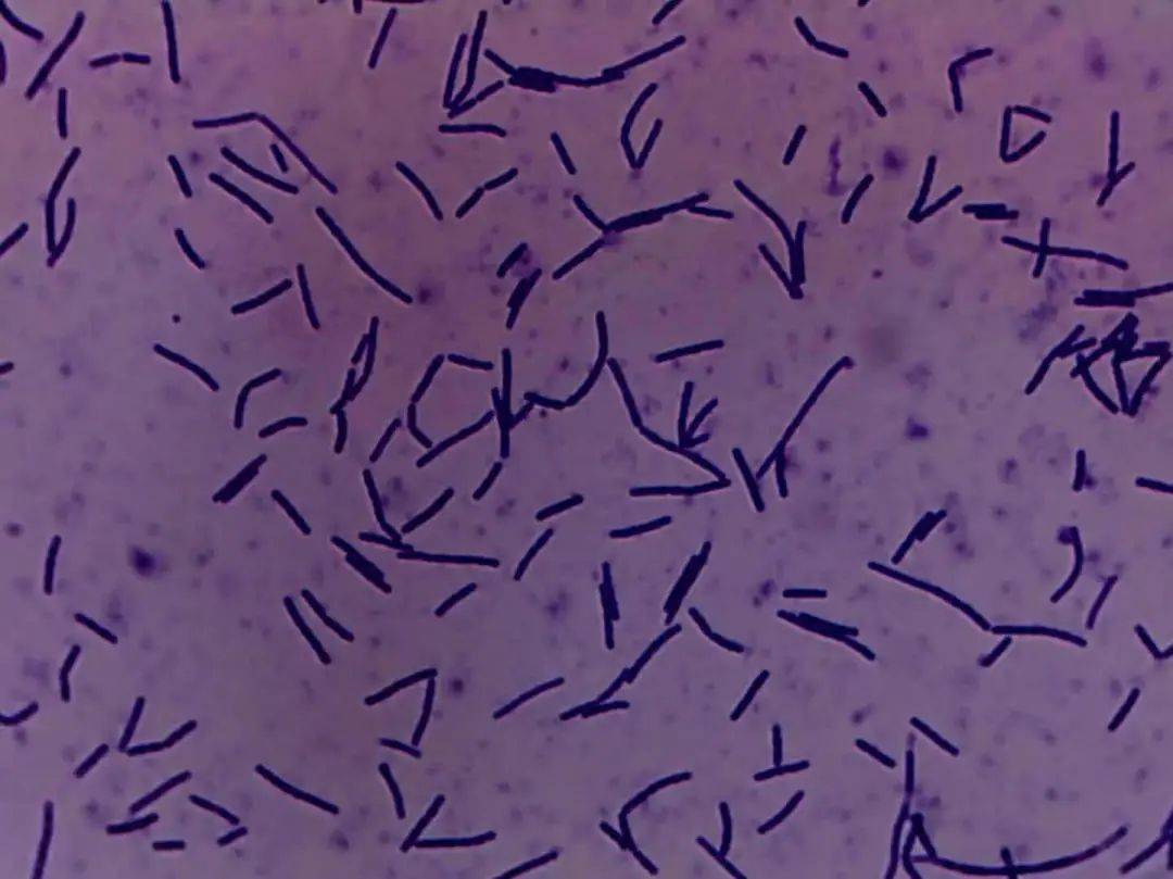em菌显微镜图片