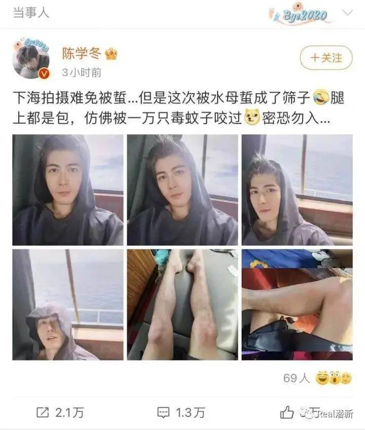 被带鱼牙齿刺伤怎么办