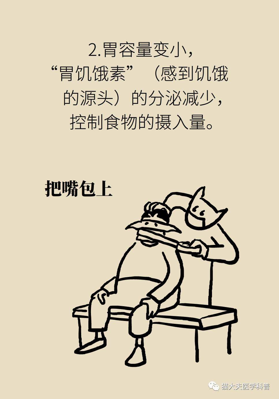 腹腔镜|什么样的人能做减重手术？专家：符合这个指标才行