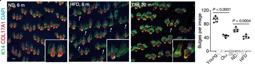 干细胞|太胖就会变秃，这回真的有依据了，日本学者发现肥胖会诱导毛囊衰竭