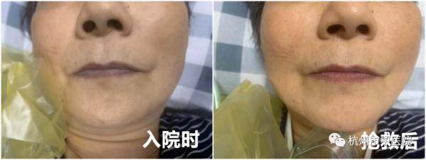 过程|杭州人爱吃的这道菜正当时，有人吃完差点没命！怎么吃有讲究……