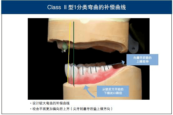 新書上線阿部二郎監著下頜吸附性全口總義齒技術高級版第七批上線預售