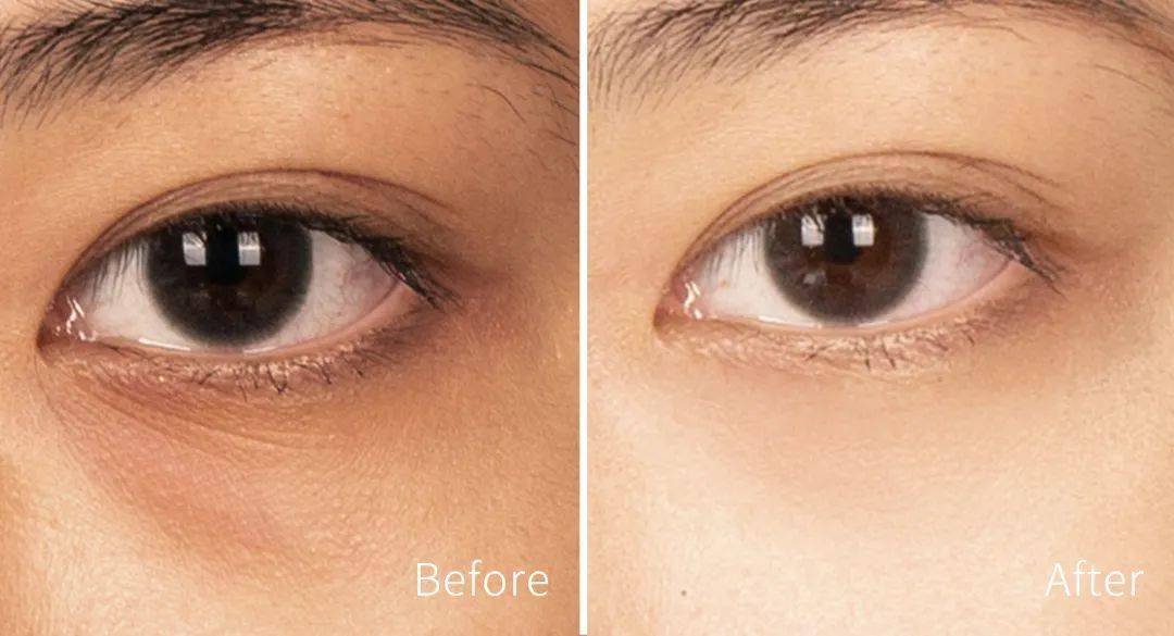 闺蜜生小孩后,皮肤