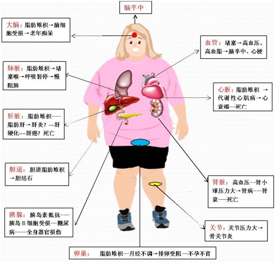 腹型肥胖人的啤酒肚就好比一個不定時炸彈,說不定哪天就