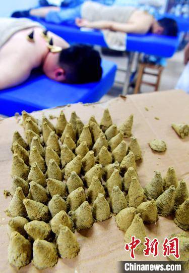 进行|盛夏三伏天 福州市民热衷“三伏灸”