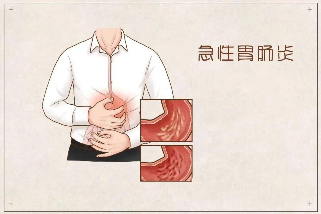 急性肠胃炎图片病情图片