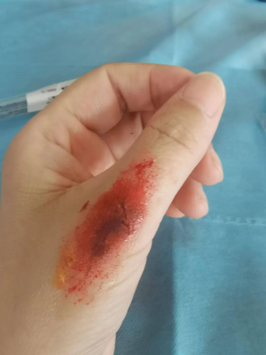 注意前方高能伤妆来袭