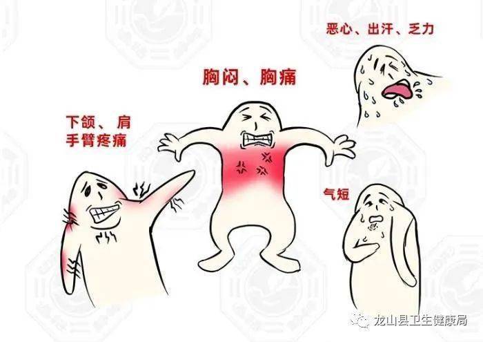 别说心梗无征兆,是你没在意!_症状