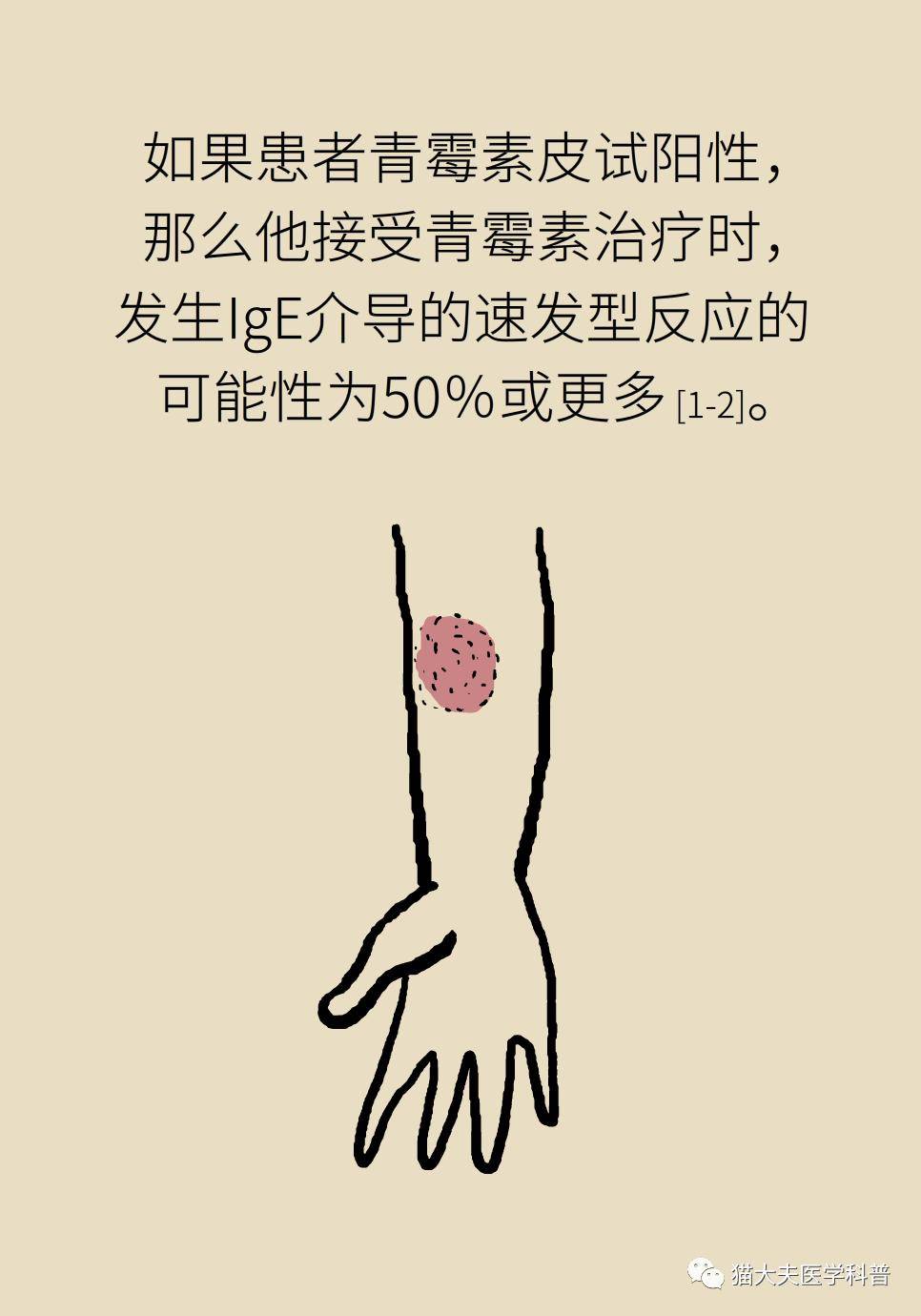 爱华|青霉素皮试没事，打针就不会过敏？