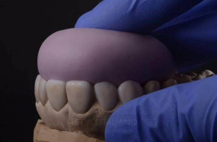 【牙医学堂】硅橡胶导板的制作细节