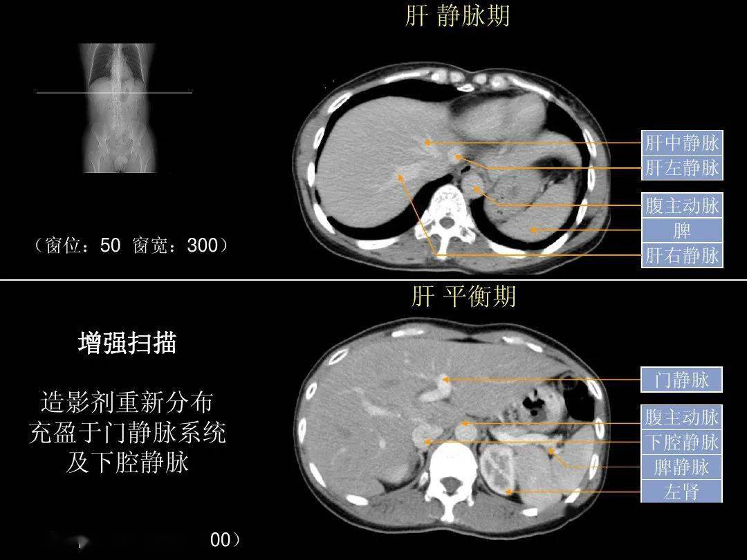 超细的腹部ct应用入门必备手册(原理 精美解剖图谱)